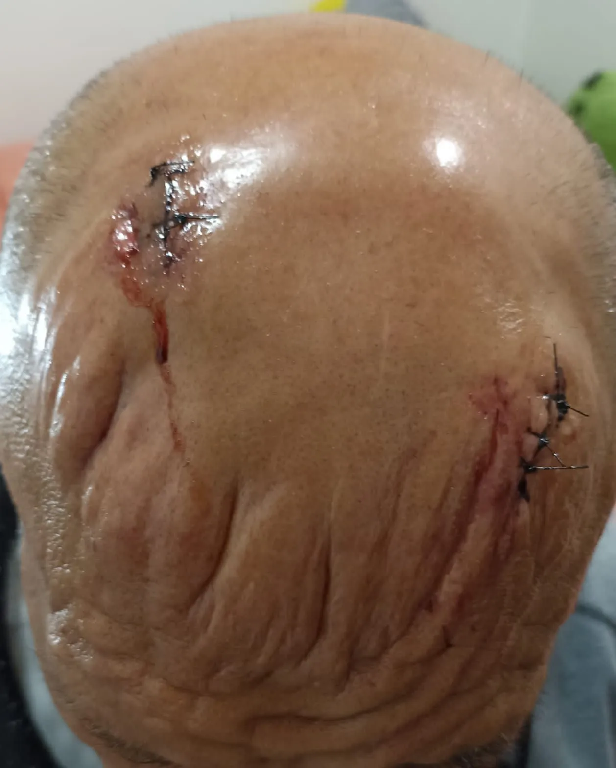 Heridas de Villano IV