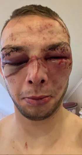 Blezien tras su pelea ante Makarowski