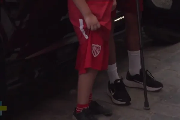 Se le fue retirado el yeso que le cubría la pierna