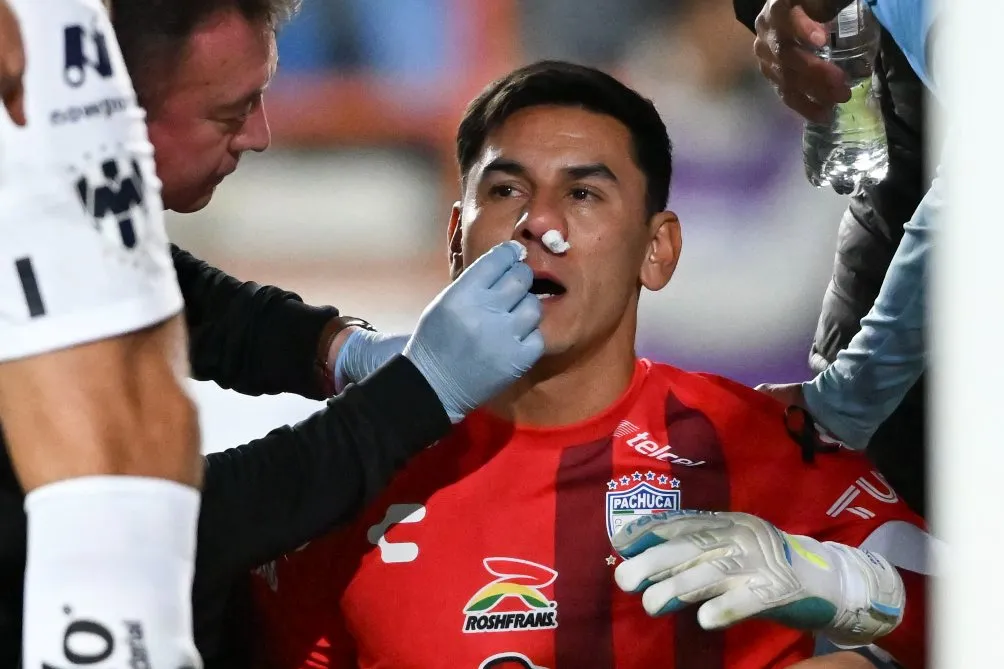 Óscar Ustari tuvo un fuerte sangrado de nariz