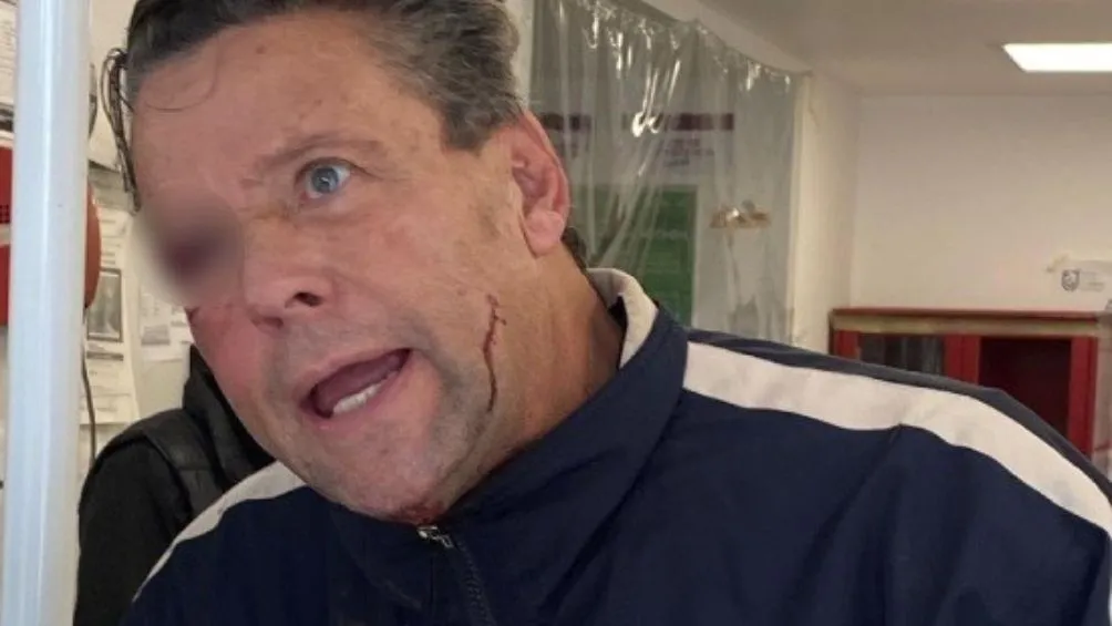 Adame ha tenido diversas broncas en la calle