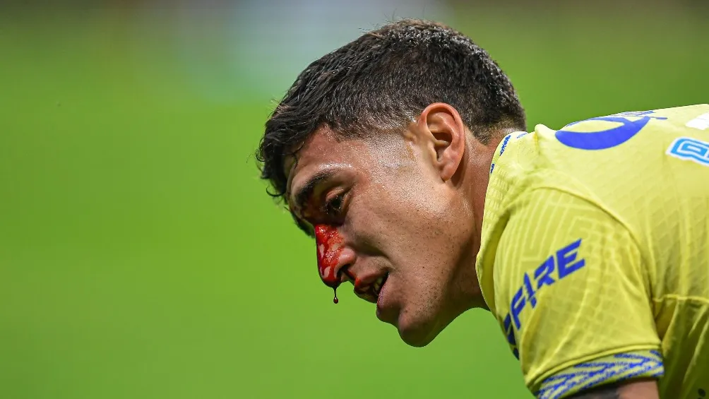 La lesión en la nariz fue bastante aparatosa