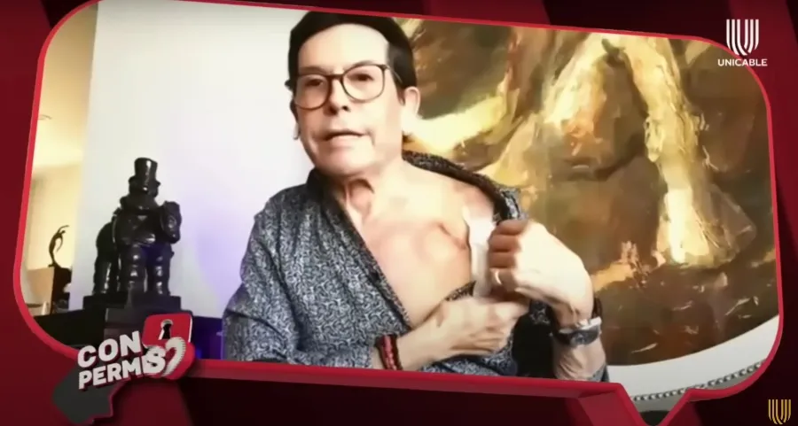 Pepillo mostró la cicatriz de su cirugía en su programa &quot;Con Permiso&quot;.