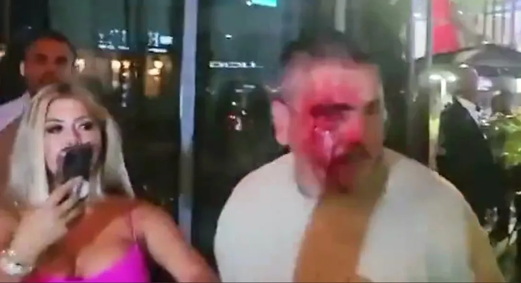 El hombre quedó ensangrentado