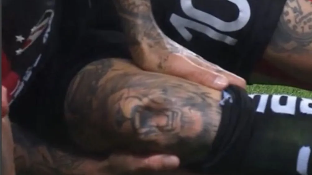 La lesión de Lozano en el Clásico Tapatío