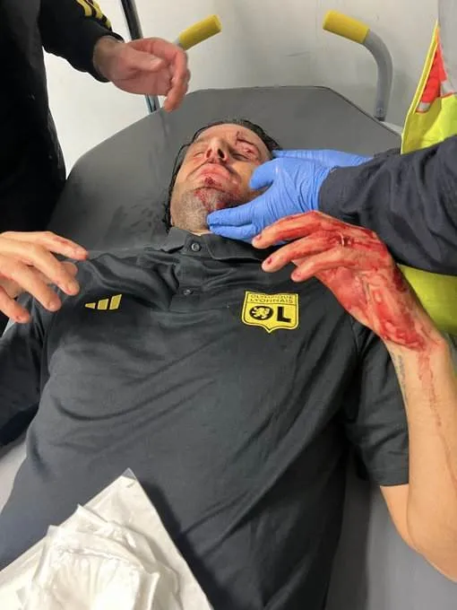 Así llegó Grosso al estadio del Marsella