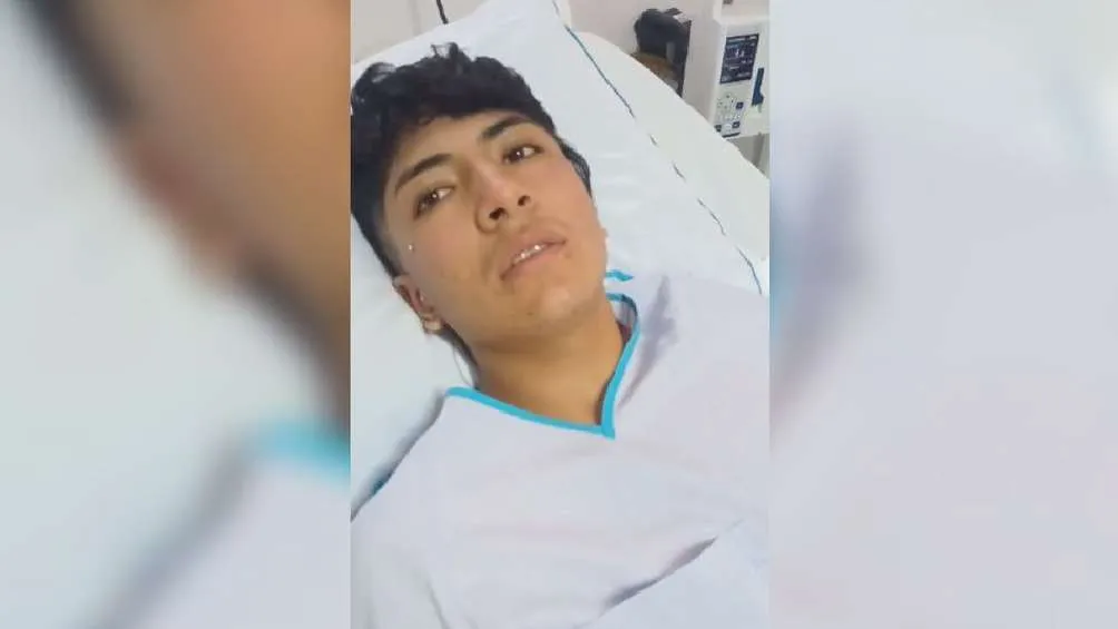 El joven Cristian sufrió quemaduras de segundo y tercer grado.