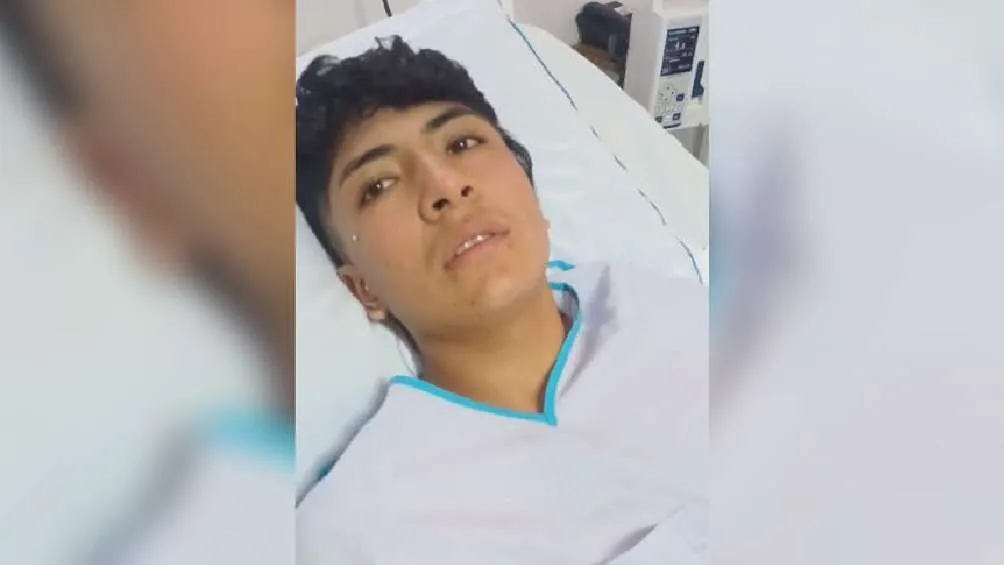 El joven Cristian Carranza sufrió quemaduras en piernas y genitales.
