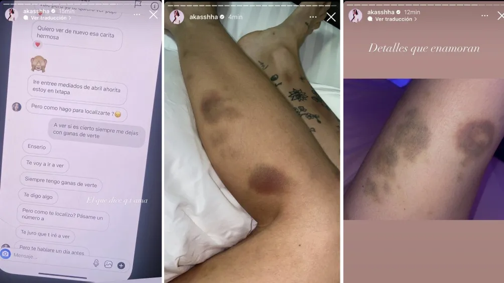 IG: @akasshha Las fotos que subió Akasha las bajó luego de que empezaron a hacer ruido.