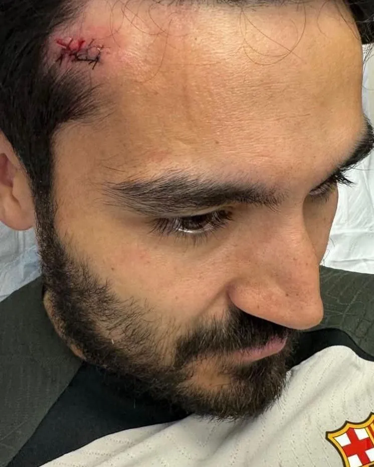 Instagram: @ilkayguendogan Golpe de Gündogan