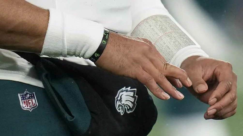 Así quedó el dedo del QB