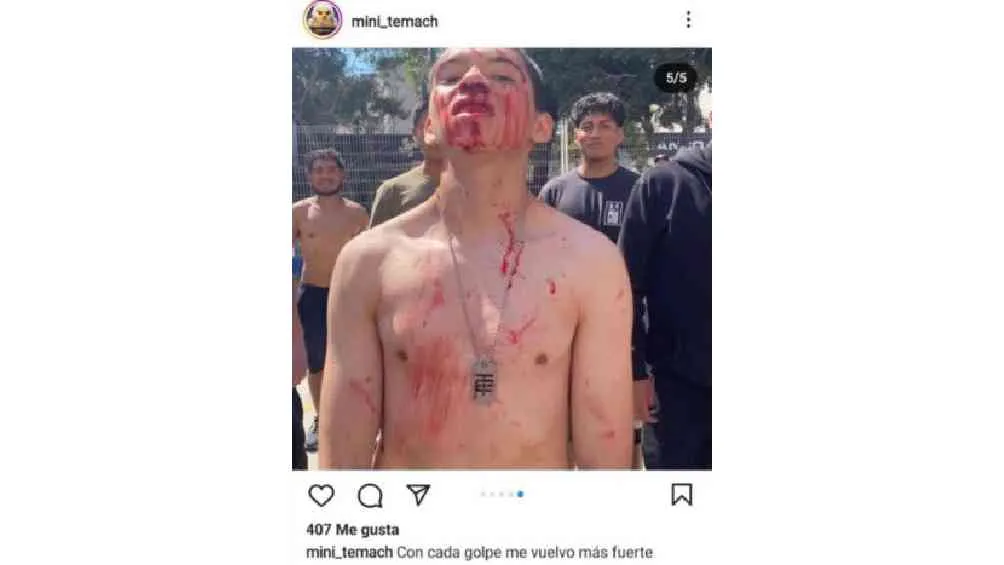 La imagen de este joven ensangrentado fue la que más críticas generó.