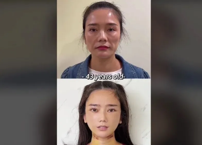 Esta es una de las publicaciones del Dr. Kim en su red social.