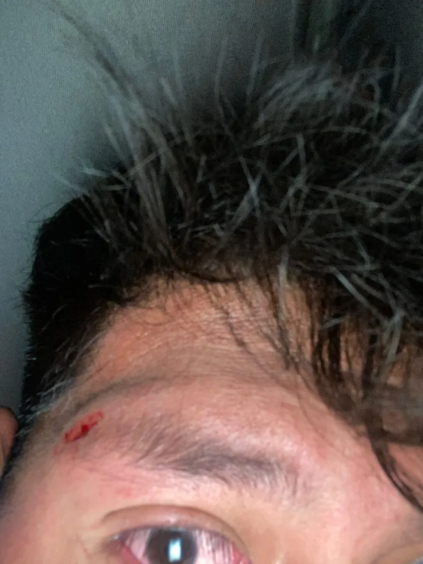 Herida a un miembro de la familia de Teresa Flores por la bronca con franeleros