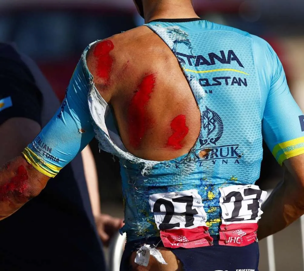 Así quedó la espalda de Tejada