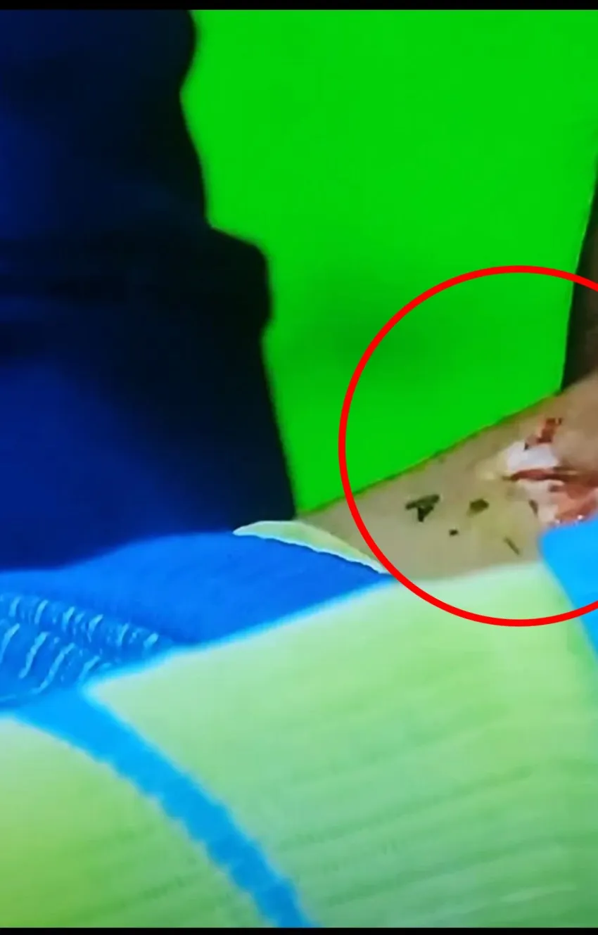 Herida en la pierna de Reyes