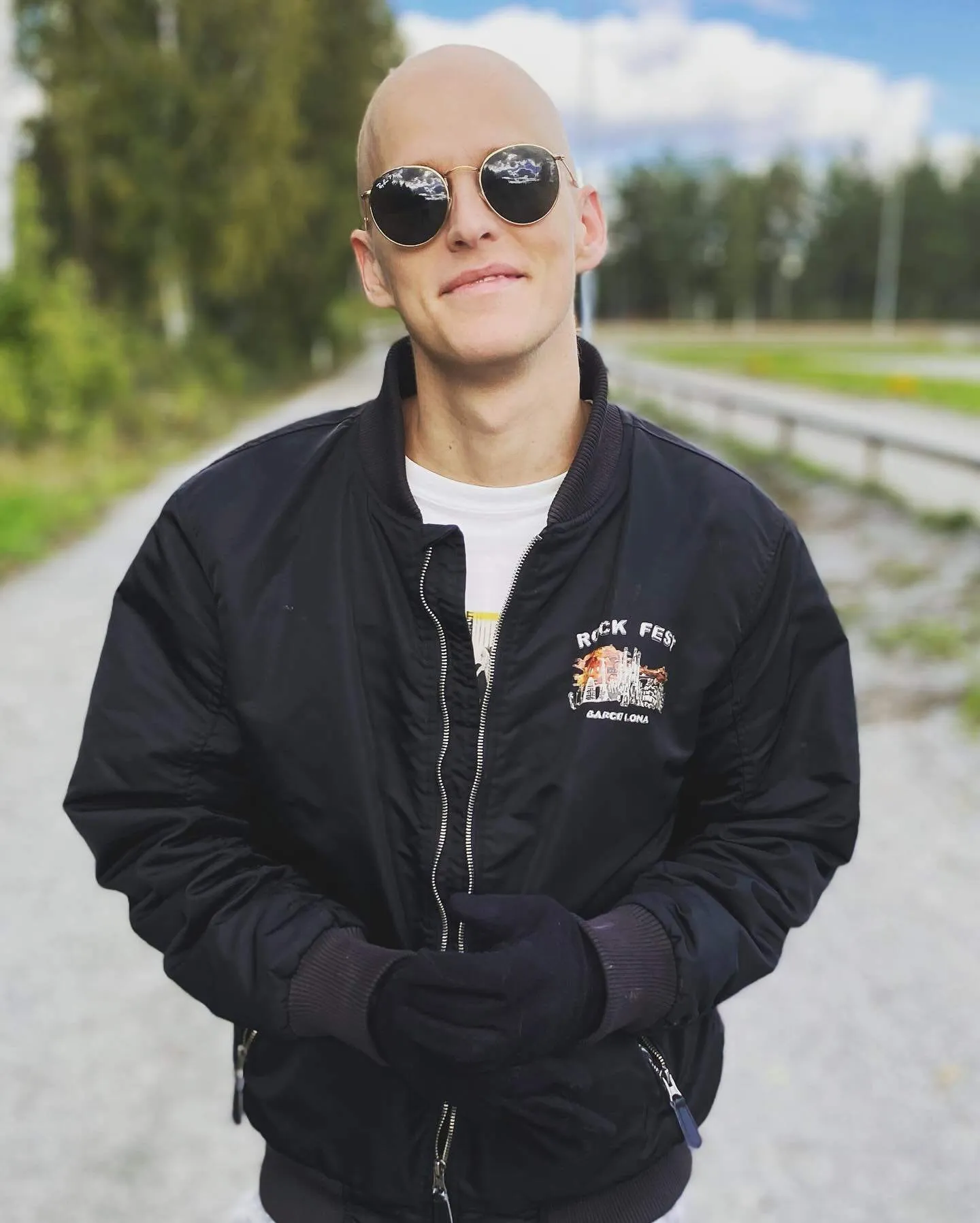 Erik Grönwall perdió la cabellera durante su tratamiento contra la leucemia.