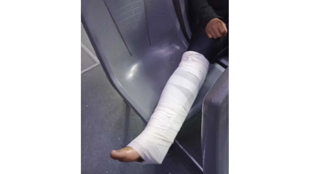 La mujer finalmente no se fracturó la rodilla, sólo fueron policontusiones.