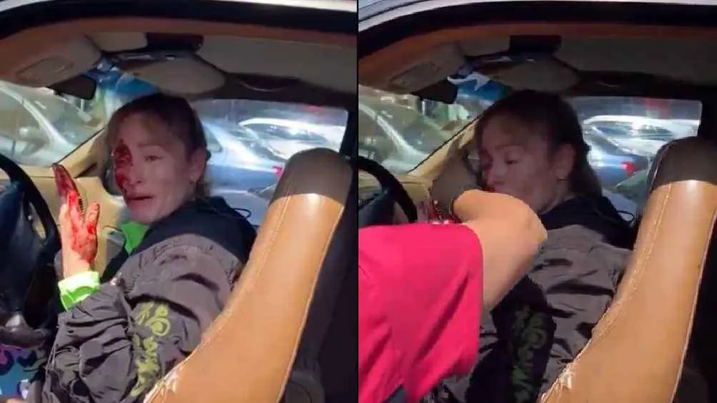 La mujer acabó ensangrentada luego de los golpes que recibió del influencer.