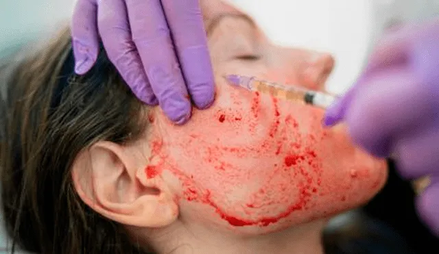 En Nuevo México mujeres contraen VIH por un tratamiento facial Foto Especial