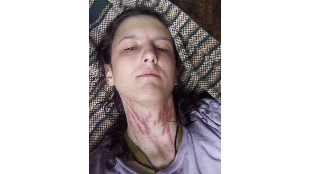 La 'acosadora de El Hatillo' es señalada de tener problemas mentales.