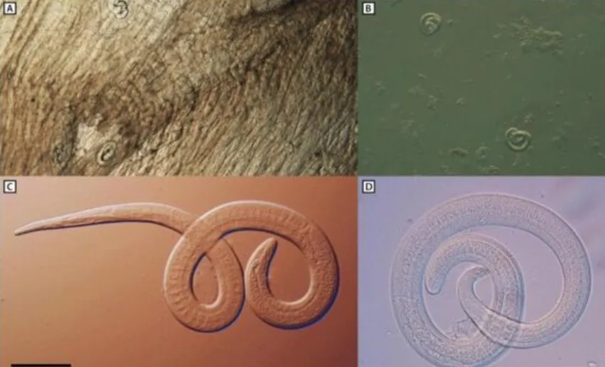 X Diferentes exámenes microscópicos de lombrices intestinales Trichinella nativa encontradas en la carne de oso negro que fue la fuente de un brote