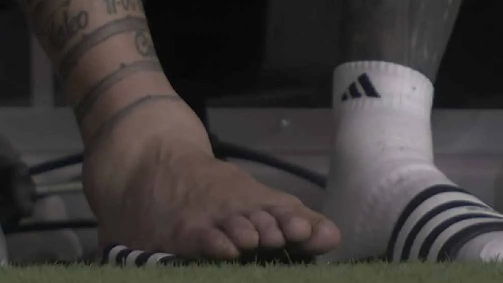 Así esta su tobillo