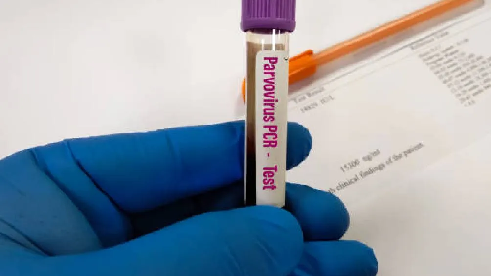 Se recomienda mantener vacunado a los perros y ante cualquier síntoma acudir al veterinario Foto iStock