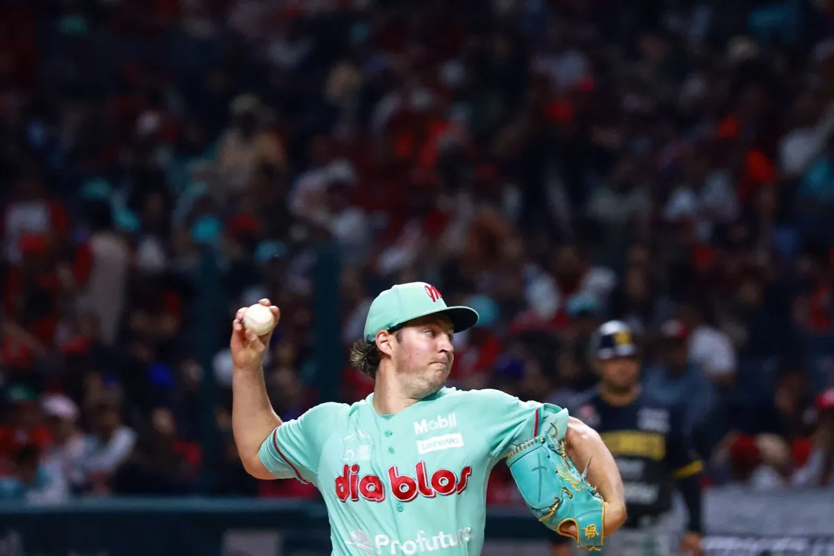 Trevor se sinceró sobre cómo se le ha tratado