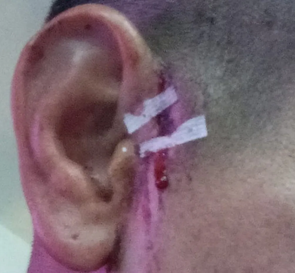 X: @Radio_RitmoSF Oreja del jugador agredido
