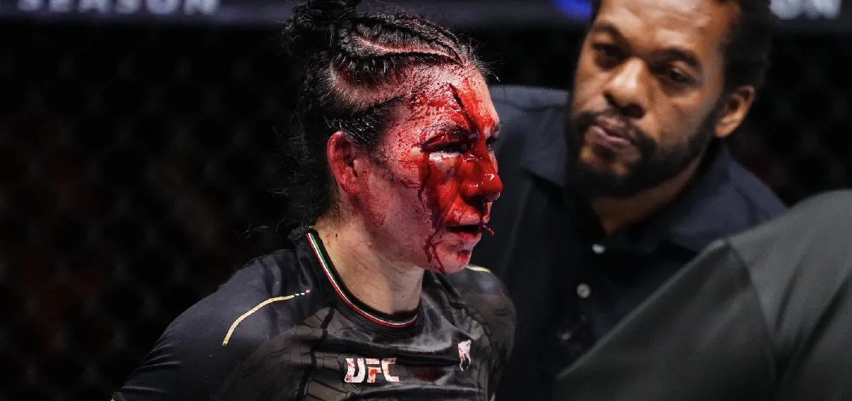 X:ComplexSports Irene Aldana