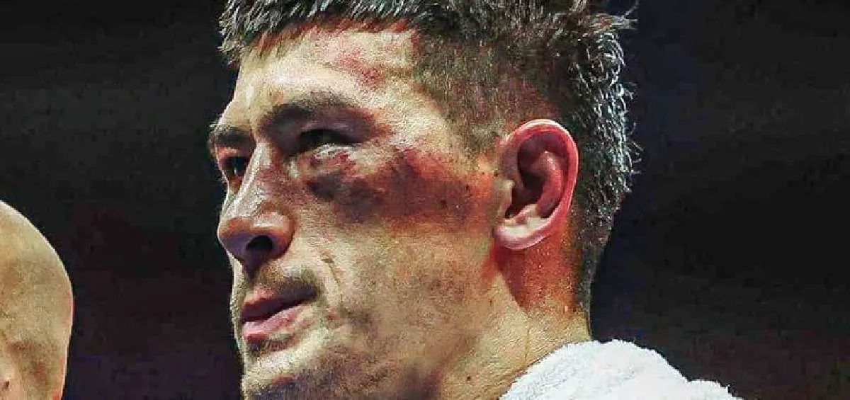 Bivol tras el combate