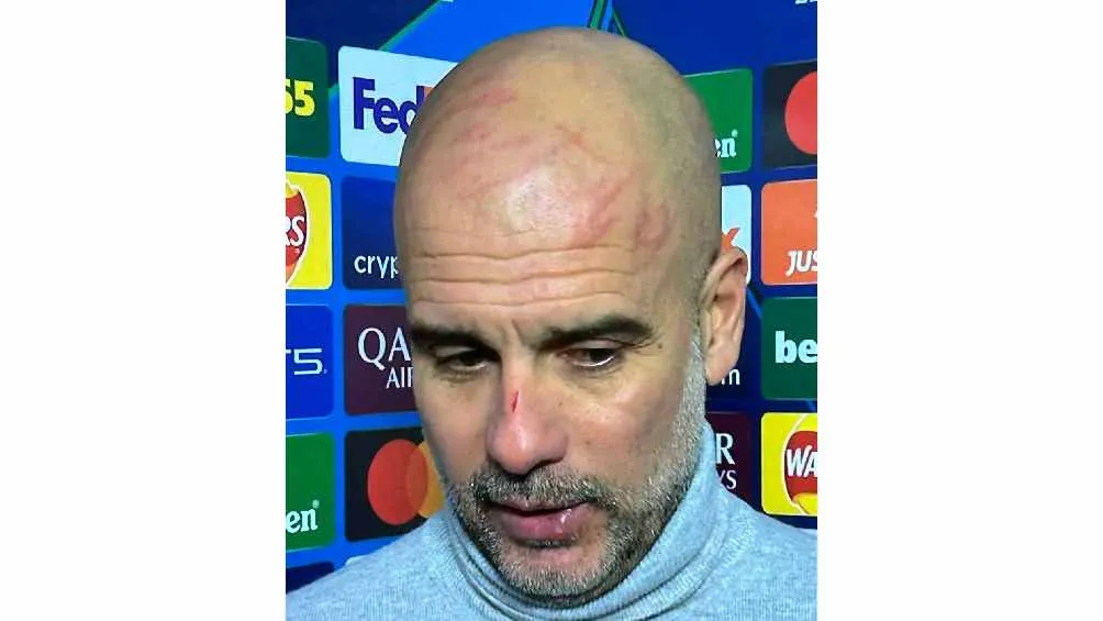 Apareció con rasguños