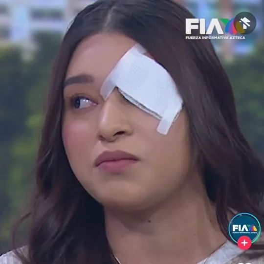 Redes Sociales Melanie podría perder el ojo por los golpes que recibió de su novio.