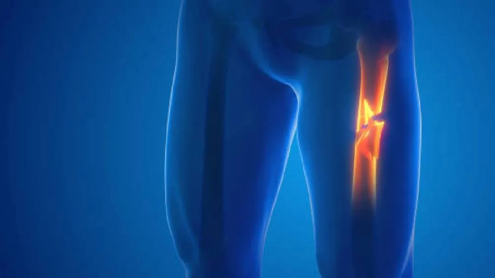 Pixabay/ Imagen ilustrativa. La arteria femoral, un vaso sanguíneo importante que suministra sangre a la parte inferior del cuerpo