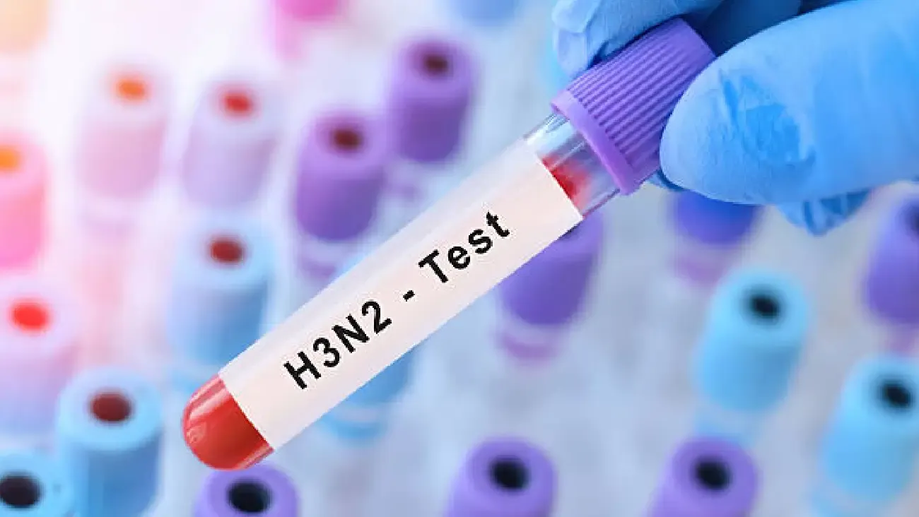 ¿Tengo gripe H3N2 tipo K? Así es la prueba que detecta esta “súper gripe”