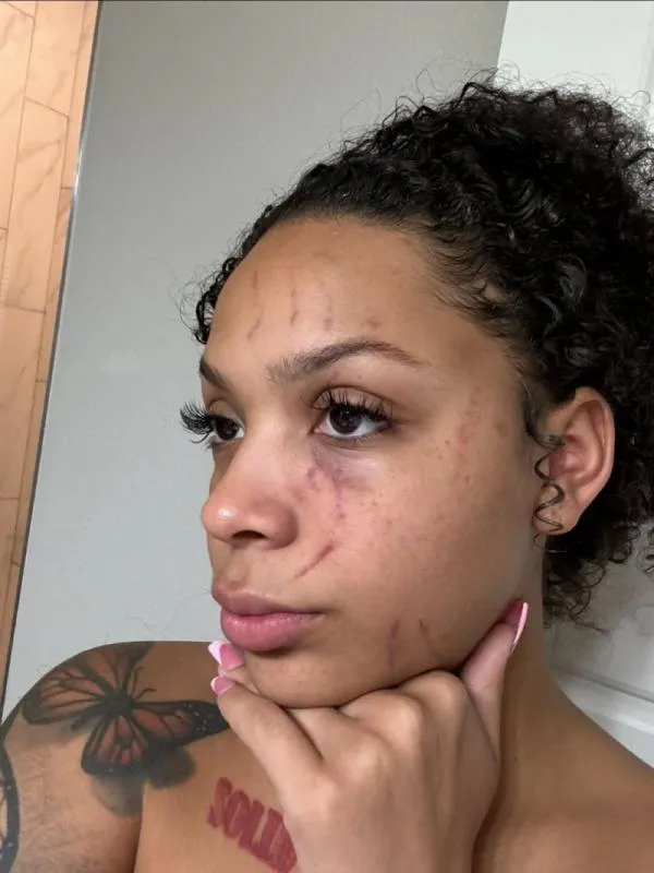 Compartió imágenes del abuso