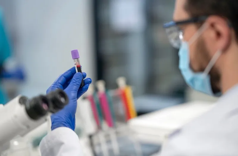 El contagio es contacto directo con animales infectados / FREEPIK