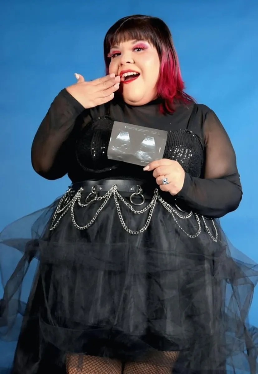 Tras nacer su bebé, sufrió algunas complicaciones de emergencia / FB: @AimeP3MarisolDominguez