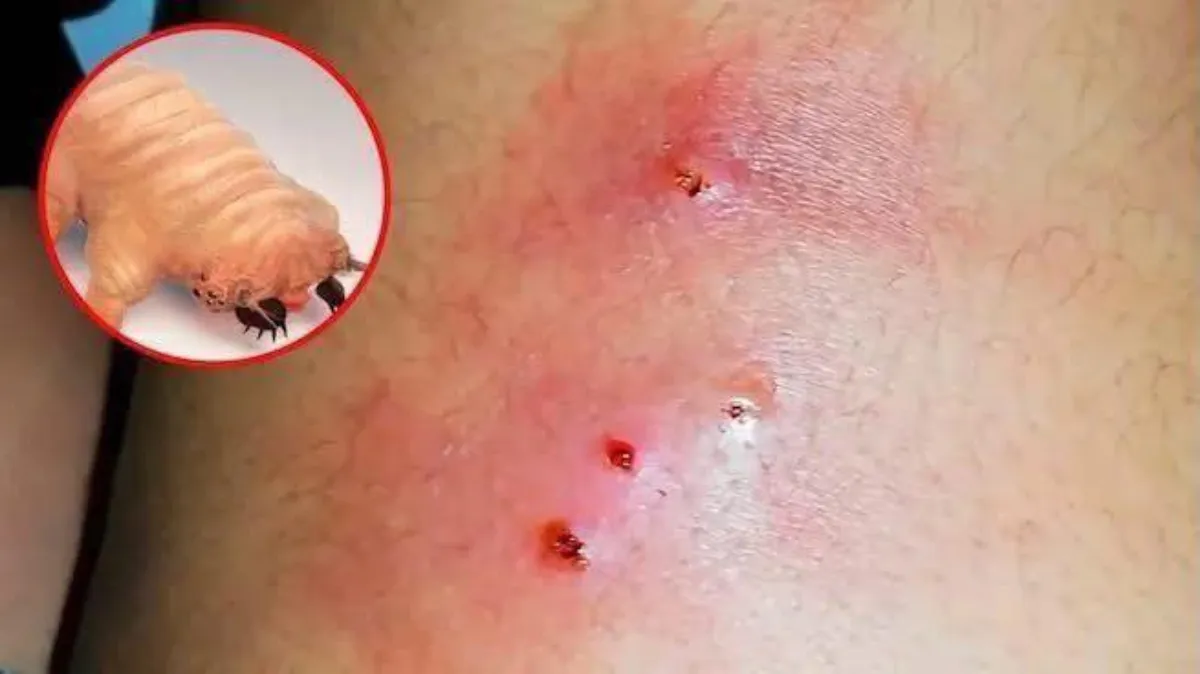 El gusano barrenador es complicado que ataque en humanos / Redes Sociales