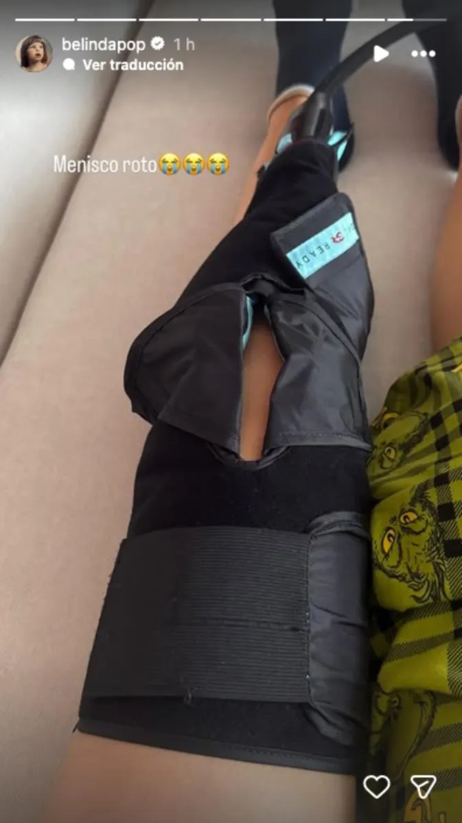 La cantante se rompió un menisco que hace que no pueda caminar bien / IG: @belindapop