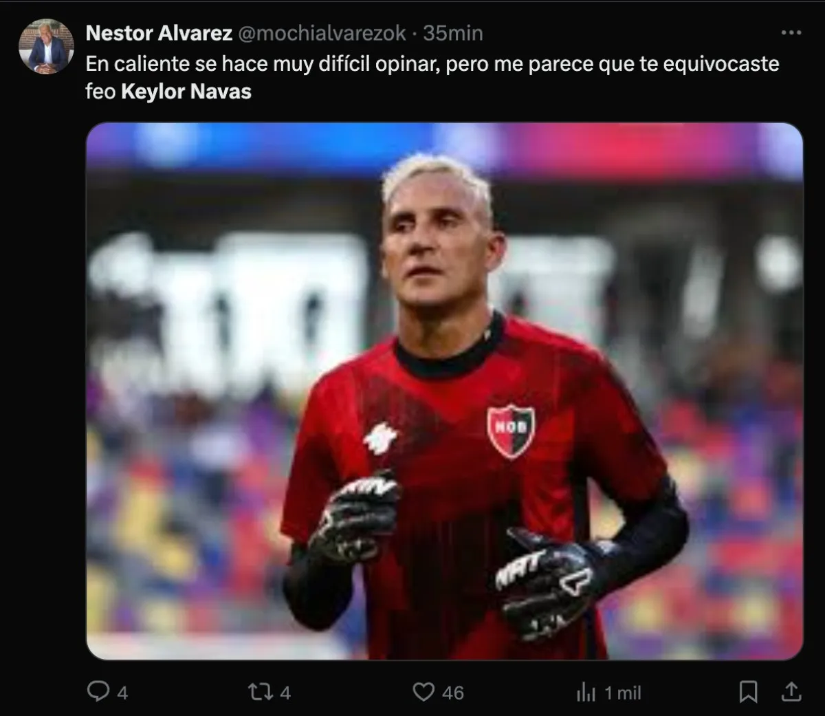 La molestia de La Lepra | CAPTURA