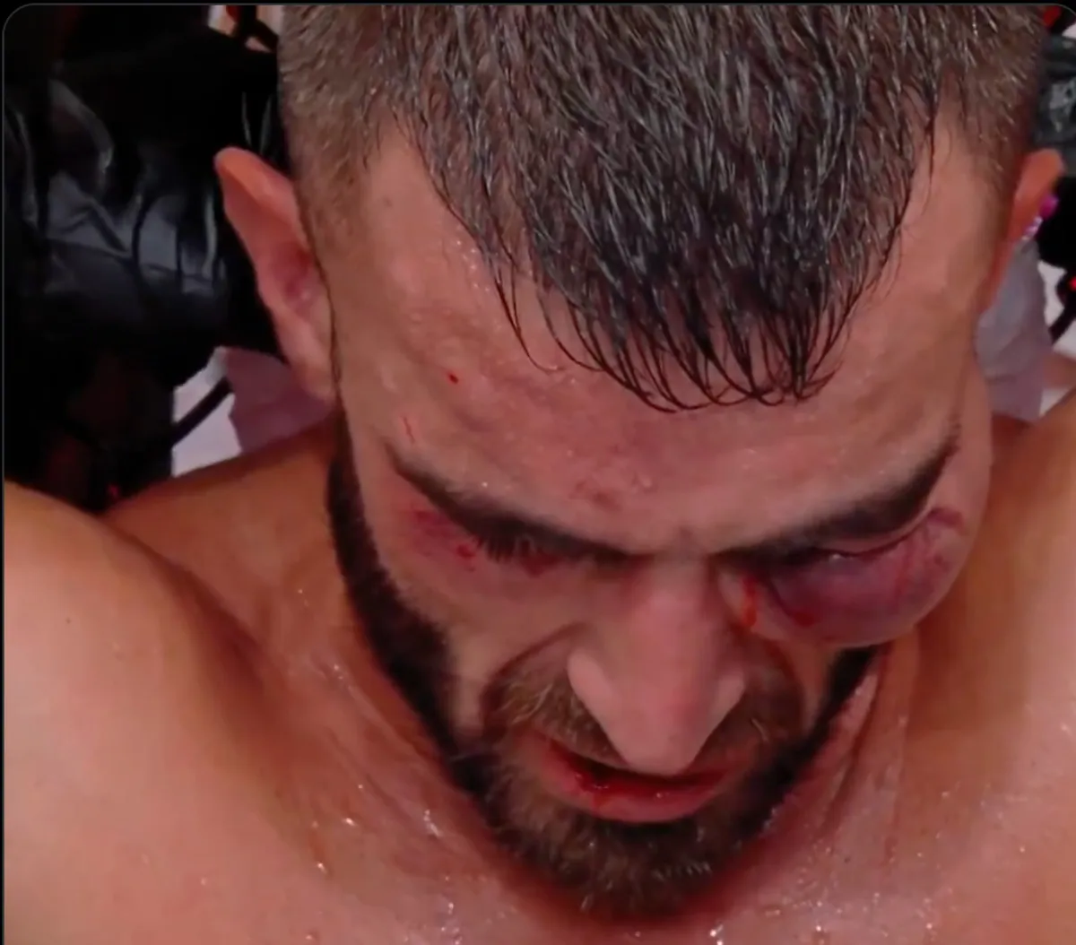 La lesión | Captura de pantalla