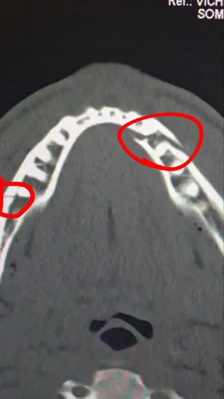 La lesión | @jakepaul