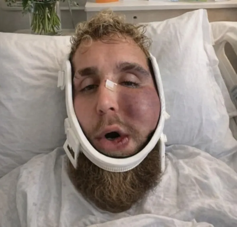 Mostró su rostro inflamado