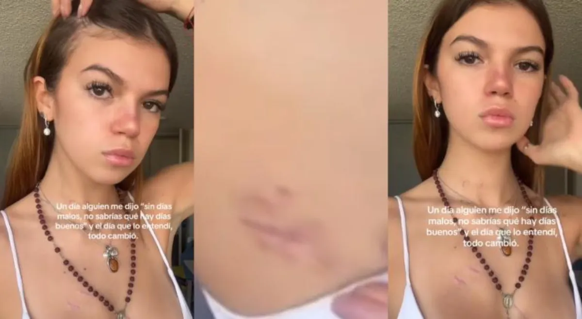 Valentina recibió 15 puñaladas que casi le cuestan la vida / Redes Sociales