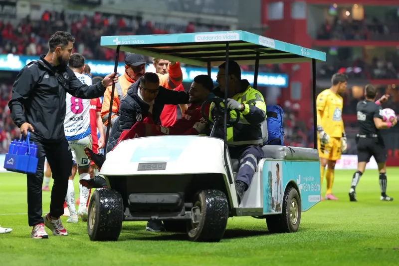 Lesión de Alexis | IMAGO7