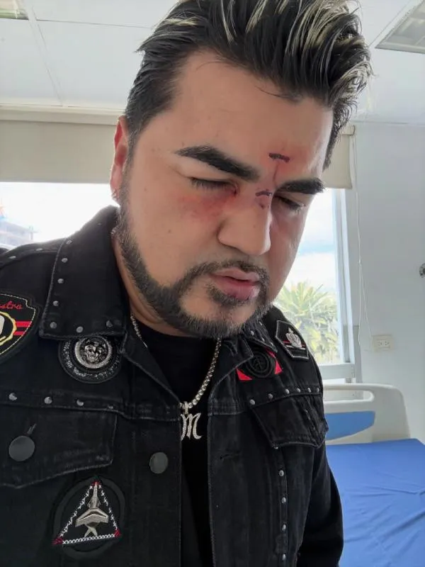 Con esta imagen, El Mimoso agradeció al doctor que lo ayudó / IG: @mimosoyo