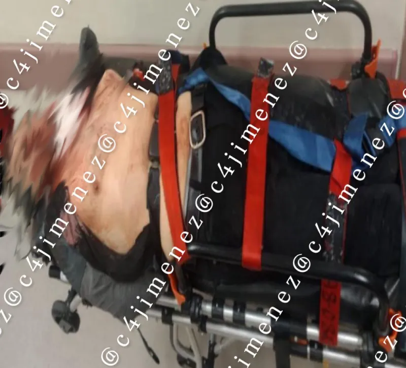 Samuel fue llevado a un hospital tras cortarse el cuello / X: @c4jimenez