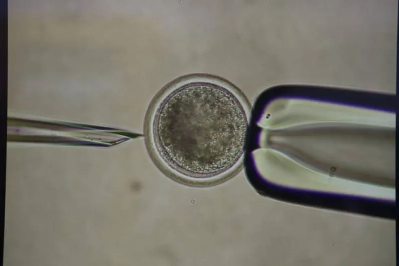 El equipo de investigadores utilizó la técnica de transferencia nuclear de células somáticas (SCNT, por sus siglas en inglés). / UAM